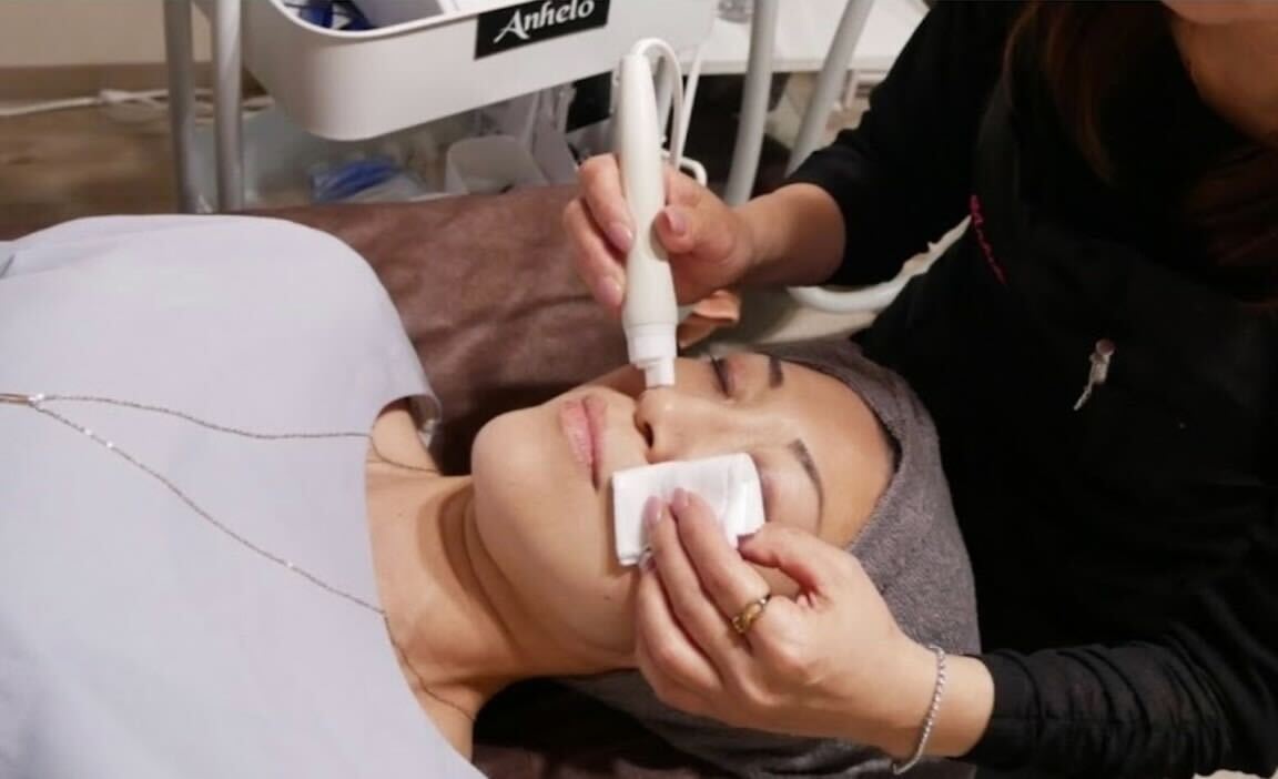 年齢・性別を問わず受けられるフェイシャル施術